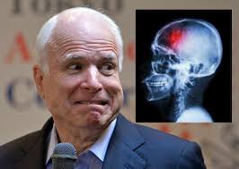 John McCain Brain Cancer